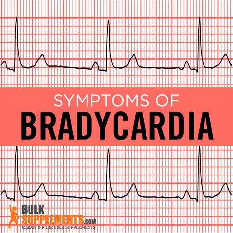 Bradycardia Symptoms Causes And Treatment