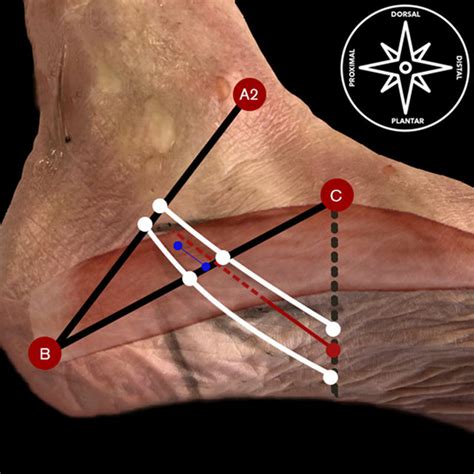 Overview Of The Main Components Of The Proximal And Distal Tarsal