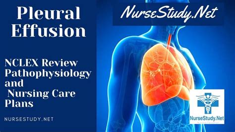 Pleural Effusion Nursing Diagnosis Interventions And Care Plans