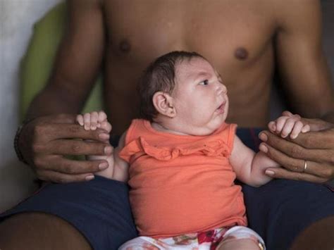 Brazil Fears Rare Birth Defects Linked To Mosquito Borne Zika Virus