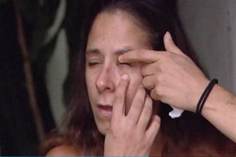 Woman Glues Eye Shut After Mistaking Superglue For Eye Drops