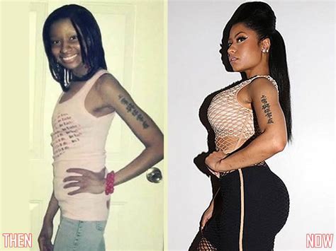 Nicki Minaj Before And After Butt Plastic Surgery