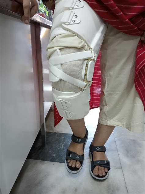 Genu Varum Brace With Joint Bow Le Corrector At Rs 4000piece Leg
