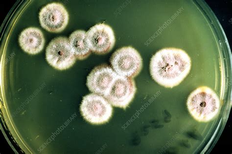 Ringworm Fungus Growing In Culture Stock Image B2500109 Science