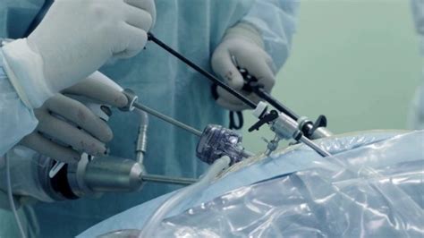 Laparoscopic Hysterectomy Surgical Removal Of Uterus Onp Hospitals