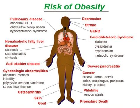 Obesity And Growing Health Risks Doctor Asky