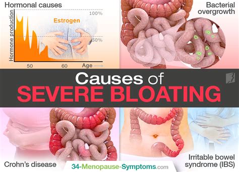 What Causes Severe Bloating And Diarrhea Pelajaran