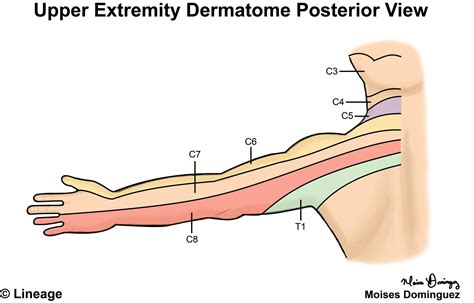 Dermatome Map Upper Extremity San Antonio Map