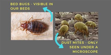 Think You Have Dust Mite Bitesthink Again