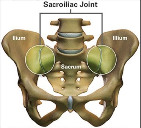 Sacroiliac Joint Dysfunction Si Joint