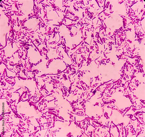 Obraz na płótnie Salmonellosis microscopic view of gram stained slide