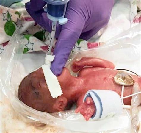 Meet Saybie The Worlds Tiniest Baby Born Ever