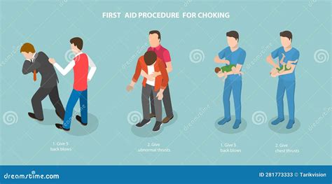 3d Isometric Flat Vector Conceptual Illustration Of First Aid Procedure For Choking Stock Vector