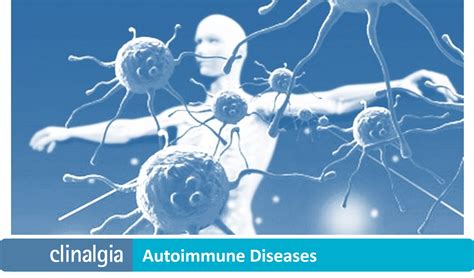 Autoimmune Diseases Find Out What They Are And Their Types