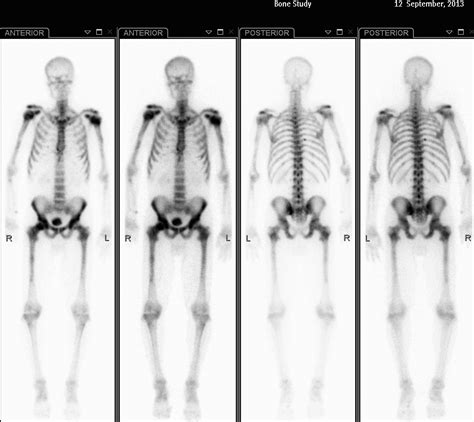 Image Radiopaedia Org