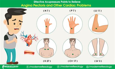 Acupressure Points For Control Cardiac Problems Acupressure Points