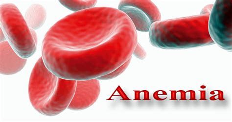 Home Remedies To Cure Anemia
