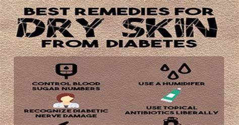 Best Remedies For Dry Skin From Diabetes Infographic Infographics