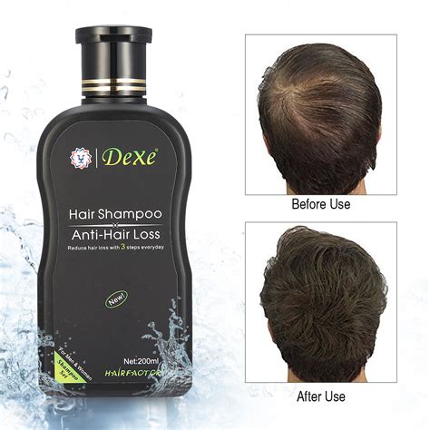 Dexe Anti Hair Loss Hair Growth Shampoo Treatment Natural 200ml For
