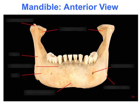 Mandible Anterior View Diagram Quizlet