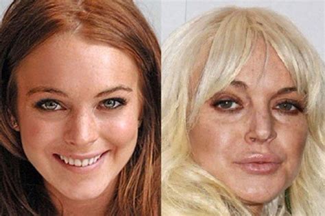 19 famosas que se hicieron cirugías de labios y todo salió realmente mal su aspecto es