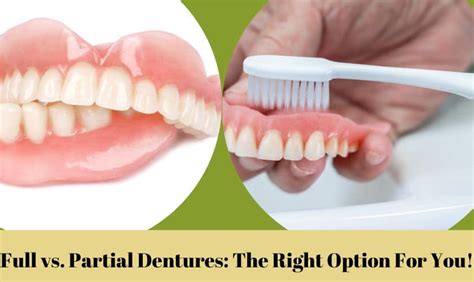 Full Vs Partial Dentures Which Is Right For You