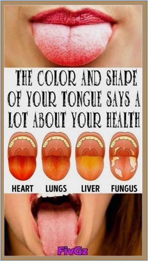 What Your Tongue Says About Your Health Wodaso Artofit