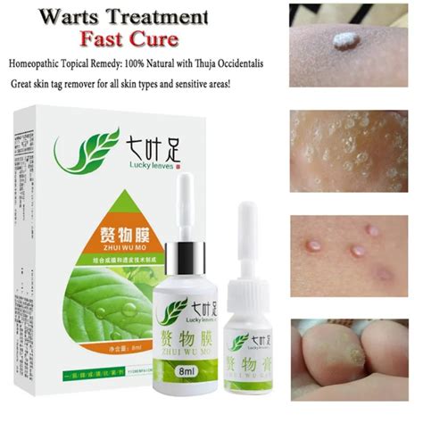hot sell professional skin tag remover natural health mole nevus wart