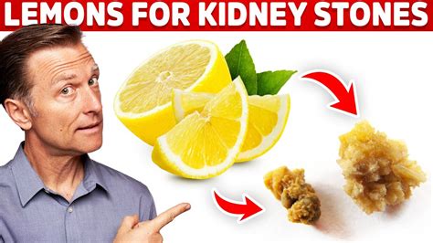 Eliminate Kidney Stones With Lemons Kidney Stone Causes And Lemon