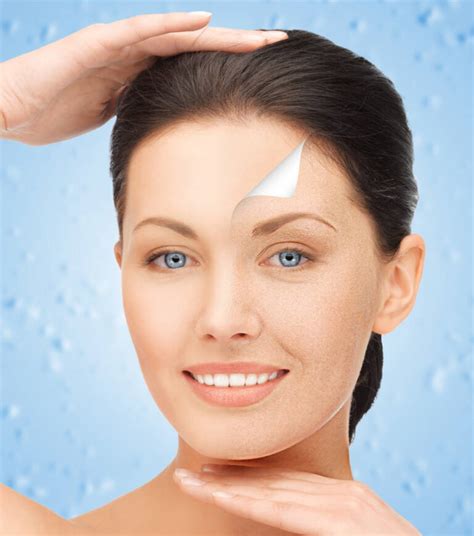 Coolpeel Laser Skin Rejuvenation Medicover Aesthetica