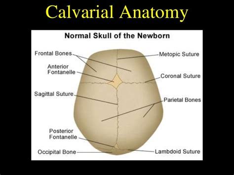 Craniosynostosis