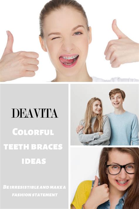 Colorful Teeth Braces Ideas Be Irresistible And Make A Fashion Statement Teeth Braces