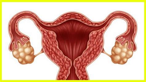 Tout savoir sur les saignements vaginaux hors périodes menstruelles