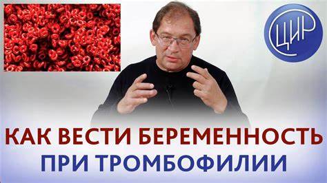 Тромбофилия беременность диета Тромбофилия при беременности. Как вести беременность при тромбофилии Тромбофилия при беременности. Как вести беременность при тромбофилии Тромбофилия беременность диета
