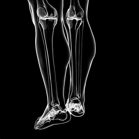 Human Leg Bones 82 Photograph By Pixologicstudioscience Photo Library