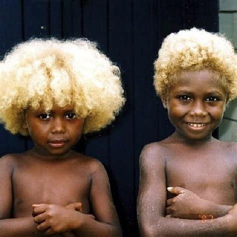 Brown Skin Blond Hair Of The Melanesian People On The Solomon
