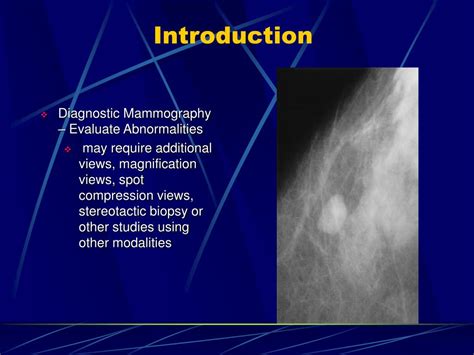 Ppt Mammography Powerpoint Presentation Free Download Id4362545