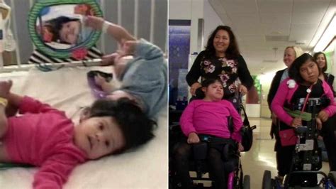 Glimpseposts Formerly Conjoined Twins Josie Hull And Teresa Cajas