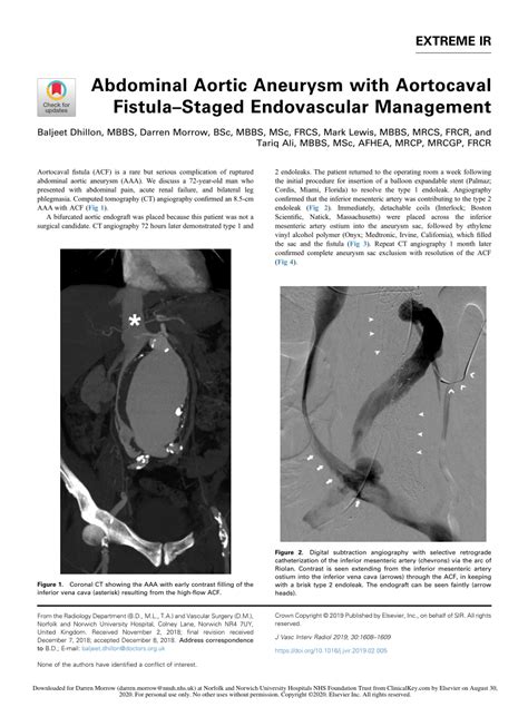 Pdf Abdominal Aortic Aneurysm With Aortocaval Fistula Staged