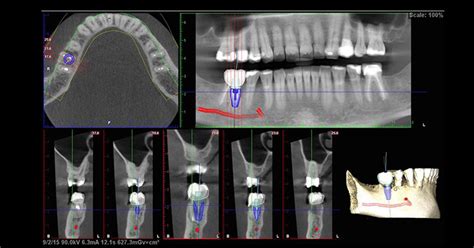 Ct Scan Uses Scenario Two Mint Hill Dentistry