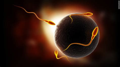 Sperm Specialist How One Clinic Is Satisfying Global Demand