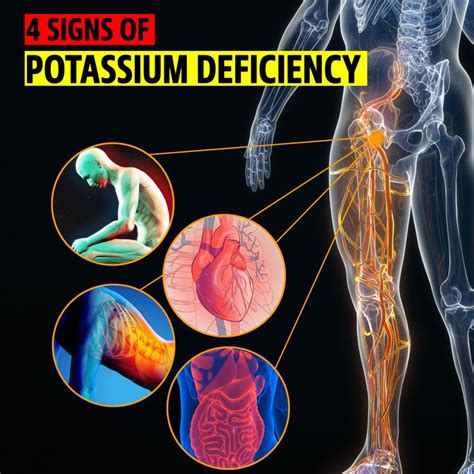4 Signs You Have Potassium Deficiency 4 Signs That Your Body Gives You To Indicate Potassium