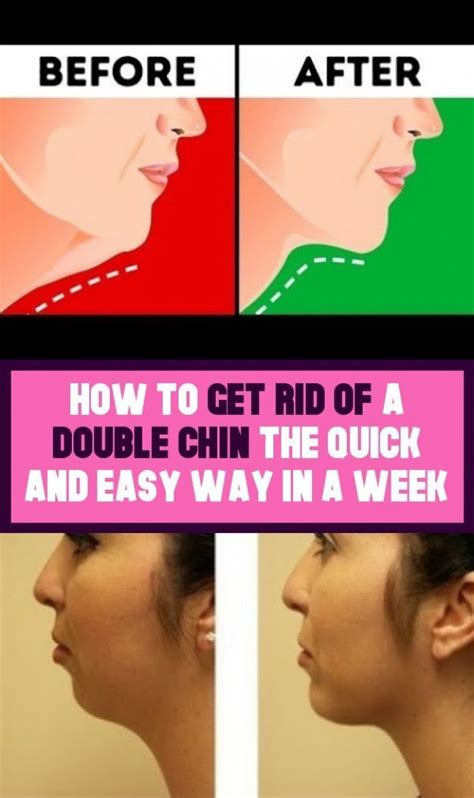 a quick and easy way with one week how to ride in 2020 double chin how to get rid double