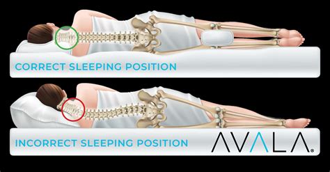 Sleeping Positions For Neck Pain Cheap Prices Save 44 Jlcatjgobmx