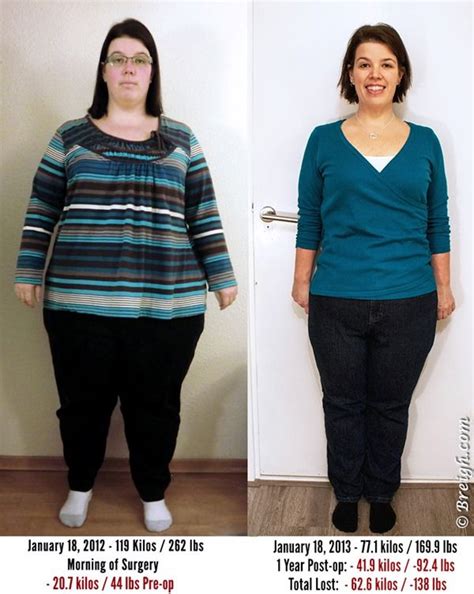 It is often challenging to restart weight loss after gastric bypass. Pin on weight loss types