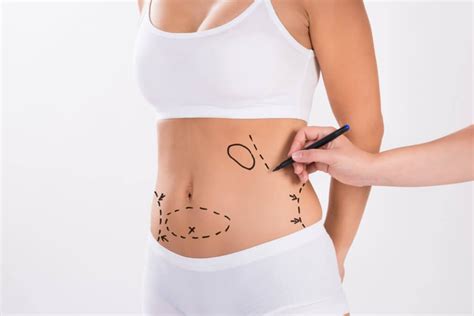 Tumescent Liposuction Price Procedure And Results Fat Procedures