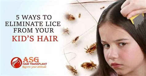5 Ways To Eliminate Lice From Your Kids Hair