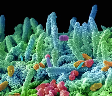 Horrifying Close Up Pictures Reveal The Bacteria Living Inside Our Mouths