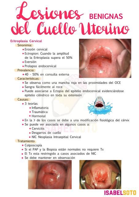 Lesiones Benignas Del Cuello Uterino UDocz