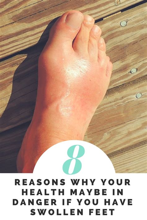 8 Reasons Why Your Health Maybe In Danger If You Have Swollen Feet